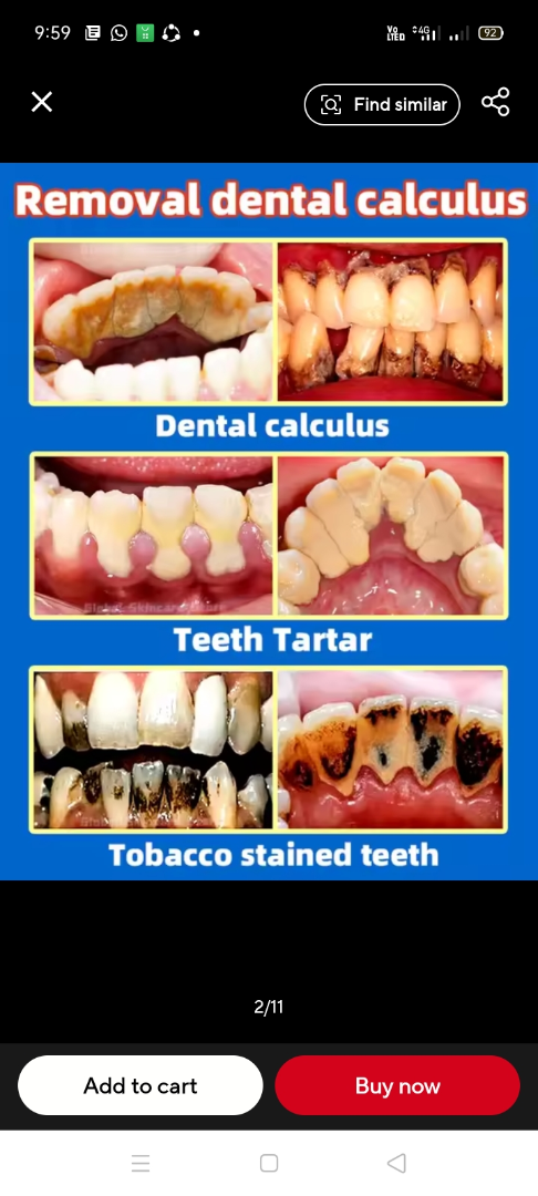 Help Every Dream of Having Healthy Teeth ✨63492465564035124