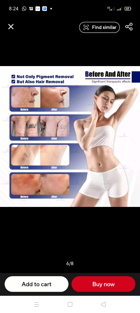 Máquina más reciente de eliminación de tatuajes con picosegundos 4Waves Pico Q-Switch Nd Yag Pigmentación Carbono ✓63468093921283120
