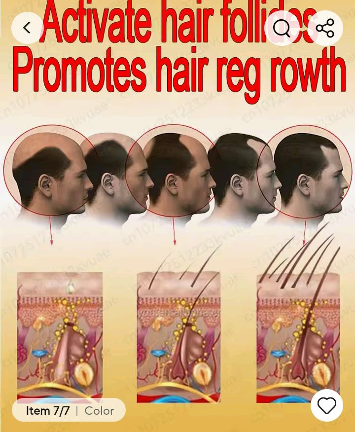 Tratamiento para la pérdida de cabello Ac63427377243139123
